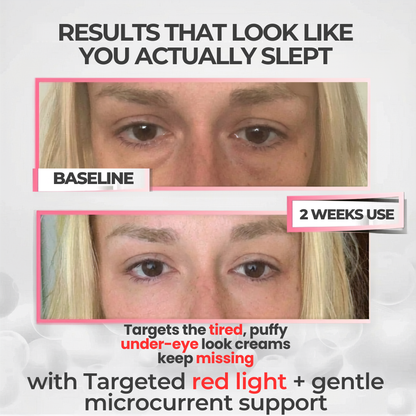 Auralis™ Hands-Free Red Light Therapy Glasses for Dark Circles & Puffiness